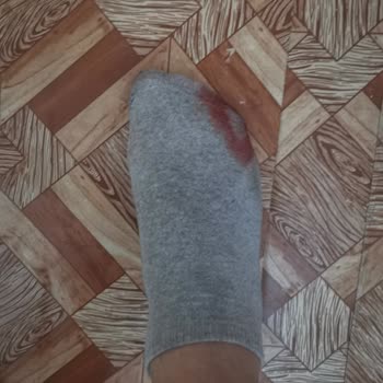 Yeni Aldığım Adidas Halısaha Ayakkabılarım Her Maçta Ayağımı Kanatıyor