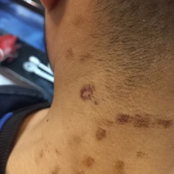 Suit Güzellik Merkezleri Gaziantep'teki Suit Güzellik Merkezinden Aldığım Paketle İlgili Sorunlar