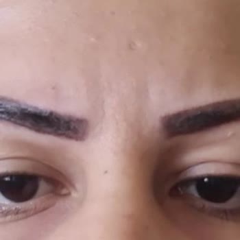 Özlem Atalay Estetik Ve Güzellik Merkezi (Ankara) Hatalı Kaş Pudralama