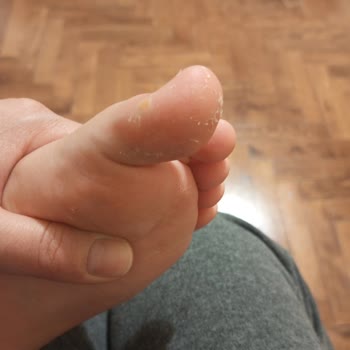 Kinetix Ayakta Yara Yaptı