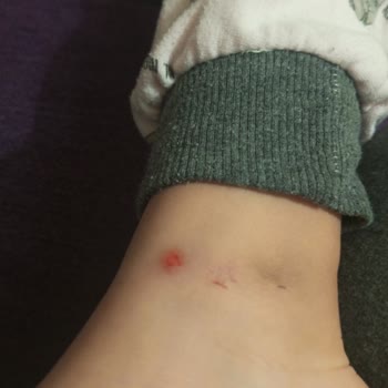 Kinetix Ayakta Yara Yaptı