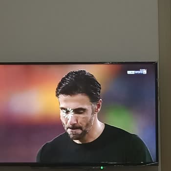 Toshiba TV Smart TV Donma Problemi