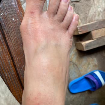 Derimod Sağlığa Zararlı Ayakkabı