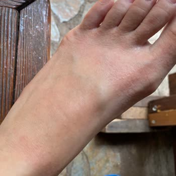 Derimod Sağlığa Zararlı Ayakkabı