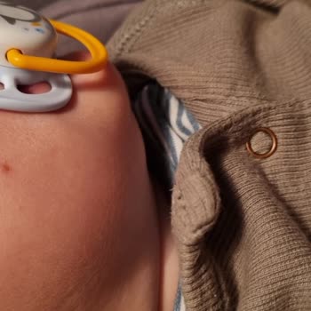 Kiperin Collagen Kiperin Kolajen Sivilce Sorunu