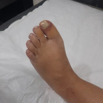 Eylül Öztürk Nail Spa Pedikür Tırnağımdan Oluyordum