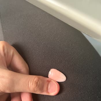 Aymira Koçaklı Yaşam Merkezi Kapsül Tırnak Kopması