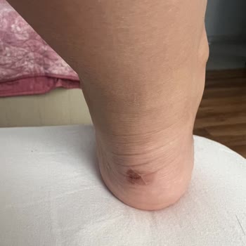 Lacoste Perakende Markası Ürünün Arkasında Durmuyor