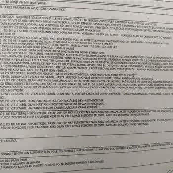 Motek Temizlik Setinin Sapı Elimi Parçaladı