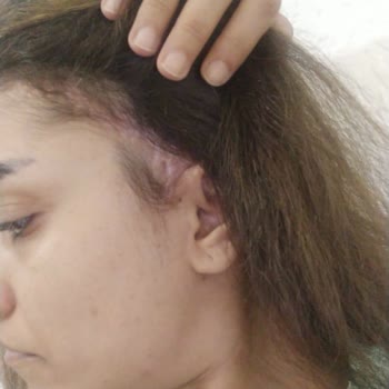 Beylikdüzü Estetik Ve Güzellik Ve Yeni Nesil Estetik Klinikteki Mağduriyetim