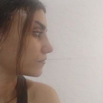 Beylikdüzü Estetik Ve Güzellik Ve Yeni Nesil Estetik Klinikteki Mağduriyetim