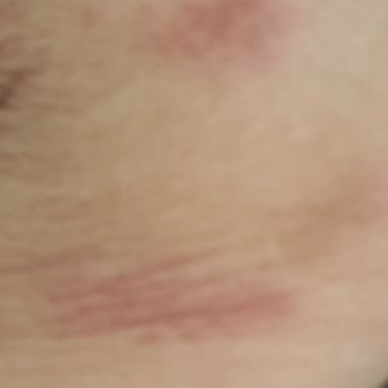 Rexona Deodorant Tenimi Yaktı