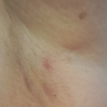 Rexona Deodorant Tenimi Yaktı