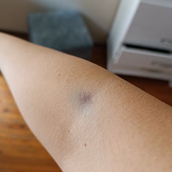 Özel Ege Yaşam Hastanesi İlgisizliği