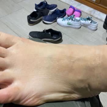 Lacoste Ayakkabıyı Giyemiyorum Ayaklarımda Su Topluyor Ve Firma Kabul Etmiyor?