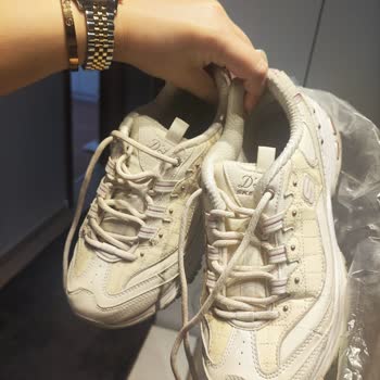 Skechers İnanılmaz Olay.! Büyük Sorumsuzluk! Çok Büyük Yanlış!
