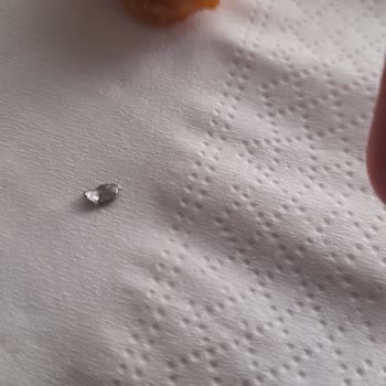 Burger King Tavuk Parçasının İçinden Metal Zarar Verici Cisim Çıktı