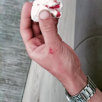 Durul Duşakabin Temperli Cam Olduğu İddia Edilen Elimizde Patladı