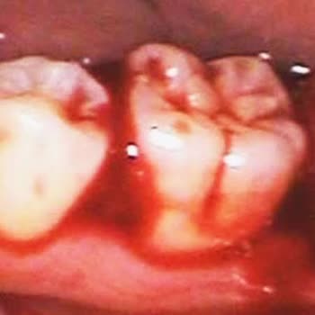 İnegöl Ağız Ve Diş Sağlığı Hastanesi, "Muayene Memnuniyetsizliği"