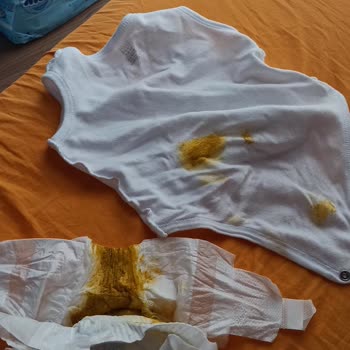 Molfix Yeni Nesil Bebek Bezi