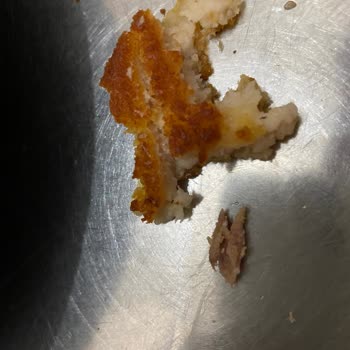 Erpiliç Şinitzelin İçinden Kemik Çıktı