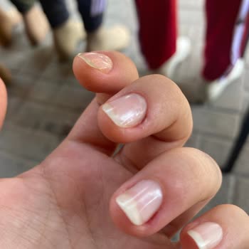 Bursa Gratis Beauty Kent Meydanı Manikür Şikayeti