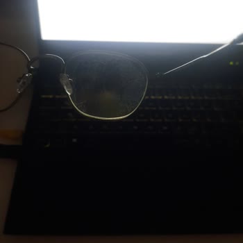 Atasun Optik Gözlük Cam Sararması ve Zamanla Oluşan Yapışkan İzi