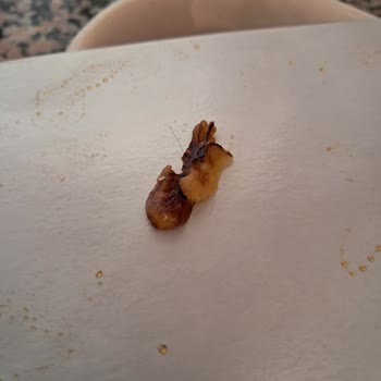 Tarım Kredi Kooperatif Market Cevizli Sucuktan Çıkan Kıl