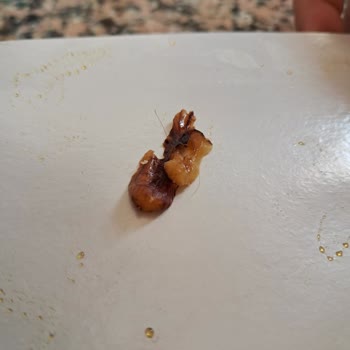 Tarım Kredi Kooperatif Market Cevizli Sucuktan Çıkan Kıl