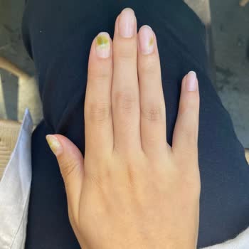 Belle Femme Güzellik Tırnaklarımda Mantar Çıktı