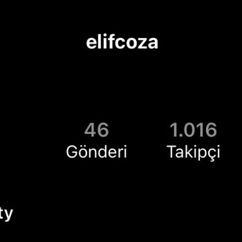 Elif Coza Beauty Lazerde Bilerek Yaktı