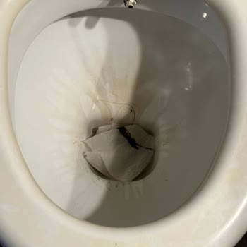 Etstur Etsden Tuttuğumuz Odada Tuvalette Kıl Yumakları