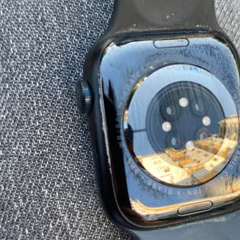 My Apple Watch 7 Is Peeling After Just 10 Months