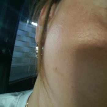 Slimfit Estetik Slimfit Bayraklı Şubesi