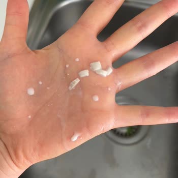 Aptamil Sıvı Mama Topaklanma Sorunu