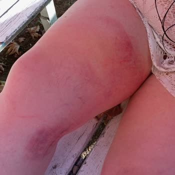 Terrace Hotel İnkum İhmalkarlıkları Yüzünden Ne Hale Geldim