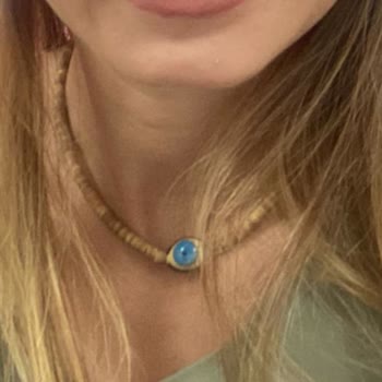 Dr. Selçuk Köroğlu Massater Botoks Şikayetim