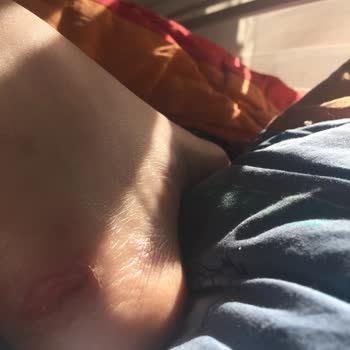 In Street'ten Nike Kalıbı Dar Ayakkabı Ayağın Topuk Kısmını Parçaladı
