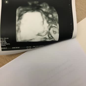 İstanbul Laboratuvarı Renkli Deyip Renksiz Çekime Ücret Alıyorsunuz