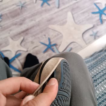 Adidas Ayakkabı Kalitesi Bu Mu?