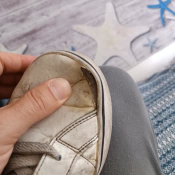 Adidas Ayakkabı Kalitesi Bu Mu?