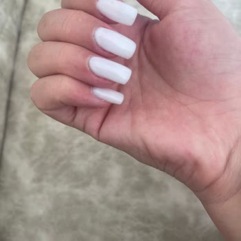 Protez Tırnak Çınare Kötü Yapılan Protez