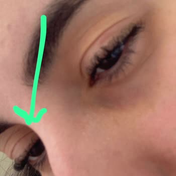 Aymira Koçaklı Yaşam Merkezi Kirpik Liftingim Lifting Değil Perma Oldu