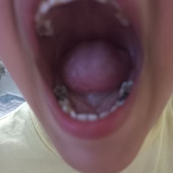 Mersin Ağız Ve Diş Sağlığı Merkezi Mersin Ağız Ve Diş Sağlığı