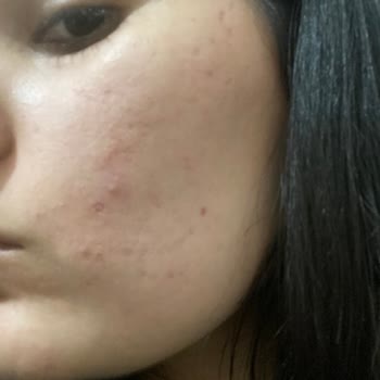 Bioderma Cicabio Krem Yüzümü Mahvetti