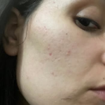 Bioderma Cicabio Krem Yüzümü Mahvetti