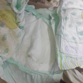 Jenny & Willy 6 Numara Çocuk Bezinde Emici Dokular Sorunu!