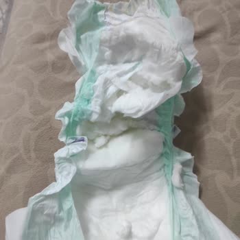 Jenny & Willy 6 Numara Çocuk Bezinde Emici Dokular Sorunu!