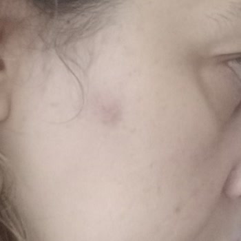 Avene Büyük Hata Güvenim Kalmadı