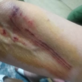 Eyüpsultan Belediyesi Bizi Ölüme Terk Ediyor